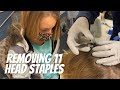 Painful staple removal from head makes ten year old pass out