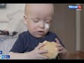 Сережа Мишин, 2 года, редкое генетическое заболевание – первичный комбинированный иммунодефицит