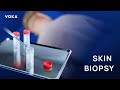 Skin Biopsy Explained: A 3D Visualization of Punch, Shave &amp; Excision Techniques