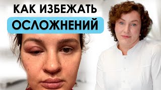 ОСТОРОЖНО | АЛЛЕРГИЧЕСКАЯ РЕАКЦИЯ НА ПРОЦЕДУРЫ | Виды и профилактика аллергии