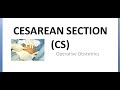 Obstetrics 691 a Cesarean section Definition History Nomenclature Define csection how name came