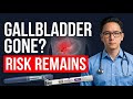 Can You Take Ozempic or Mounjaro After Gallbladder Removal?