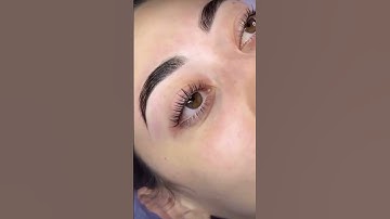 The most gorgeous combo treatment using Elleeplex Profusion 🧡⁠⁠📸