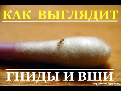 Как выглядят гниды (вши) у человека