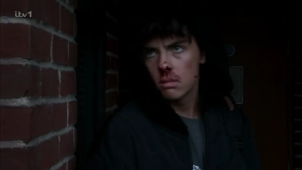 Coronation Street: Mason Radcliff...... The Aftermath Part Two