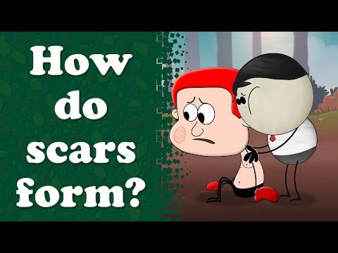 How do scars form? | #aumsum #kids #science #education #children