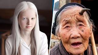 1 In a Million. These Are The Rarest and Most Unique People on Earth