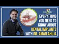 Dental Implants in India- Cost | Brands | Warranty | Cosmodent India - Dr. Aman Ahuja