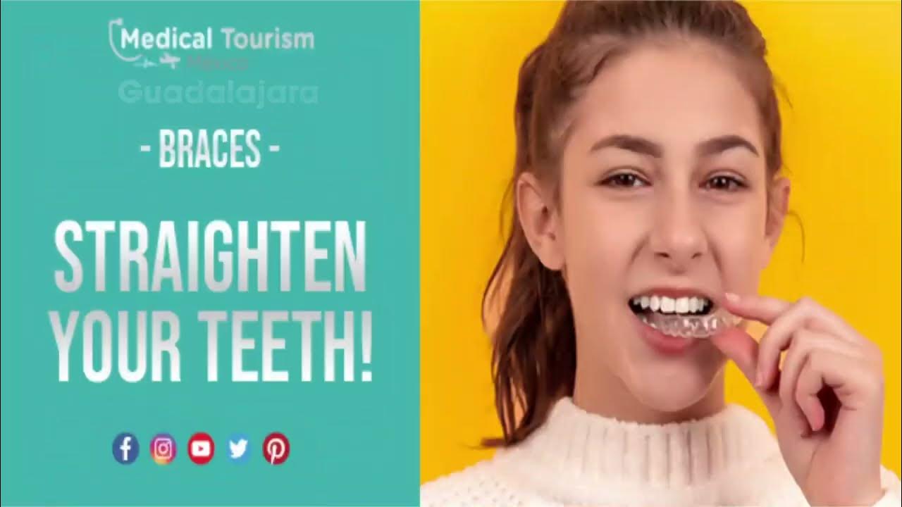 Get Dental Braces In Guadalajara Medical Tourism Mexico YouTube