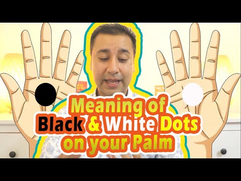 What do Black dots and White dots mean on your hands?