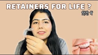 How Long Should You REALLY Wear Retainers? | The Braces Dentist