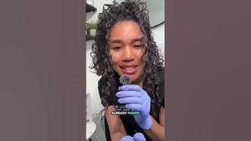 Quick skin elasticity test you can do! Did yours bounce back fast or slow? #prf #skinelasticity