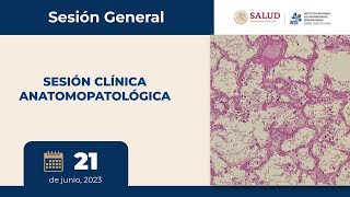 SESIÓN GENERAL: SESIÓN CLÍNICA ANATOMOPATOLÓGICA, INER