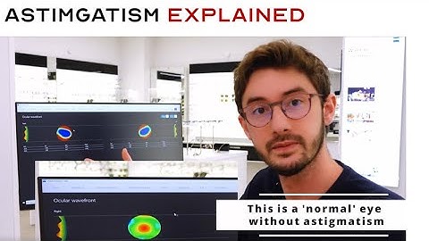 Wat is astigmatisme? De ENIGE video die u hoeft te bekijken | Wat is CYL? | Uw recept uitgelegd