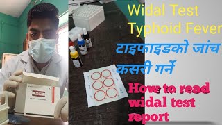 Widal Test|| Qualitative and quantitative method by slide agglutination,Typhoid fever, CMLT,BMLT