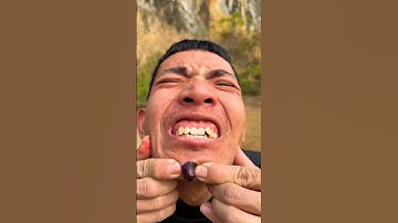 How I Cured a Bug Bite with Yogurt in the Wild | Survival Hacks