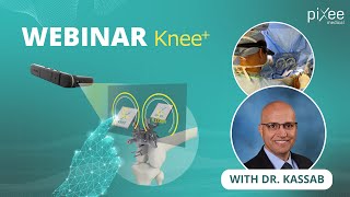 Webinar Knee+ : Discover how augmented reality empowers surgeons for TKA!