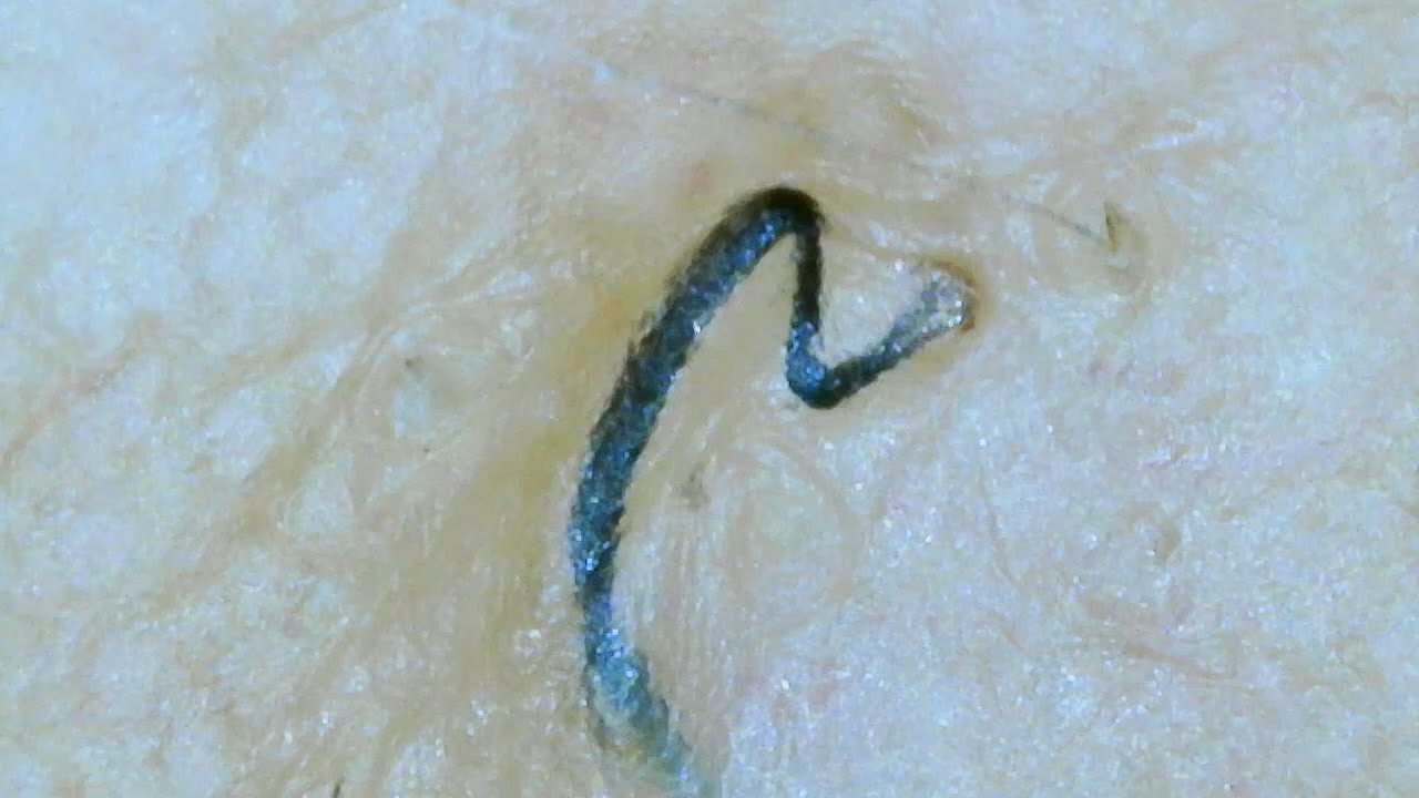Does Plucking Pubic Hair Make It Not Grow Back
