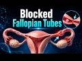 How Blocked Fallopian Tubes Affect Fertility | 3D Medical Animation #shorts