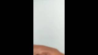 Nerve supply of Pinna external ear explained in easy way you will never forget no need mnemonic