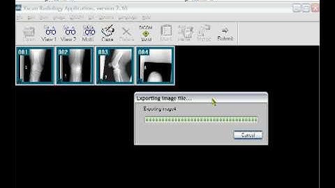 Create Dicom CD -- http://www.summitxrayinc.com