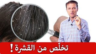 أفضل علاج طبيعي للقشرة