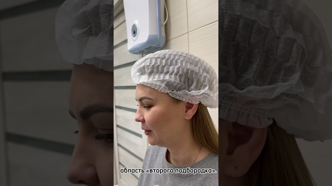 Липоредукция подбородка. Убрать «второй» подбородок легко при помощи процедуры «Липоредукция»