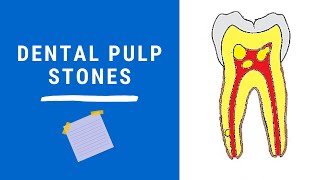 Dental Pulp Stones | Dentin Pulp Complex Session 7