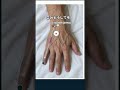 【手背ルートキープ】オペ前の血管選び！20G留置針で狙うべき位置と危険部位の避け方