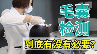 【毛发科普】毛囊检测是什么？肉眼无法分辨的头发细节都能检测出来！