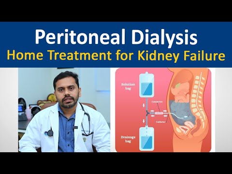 Peritoneal Dialysis | What You Need to Know | Dr Sarang Vijayan | Aster MIMS Kannur