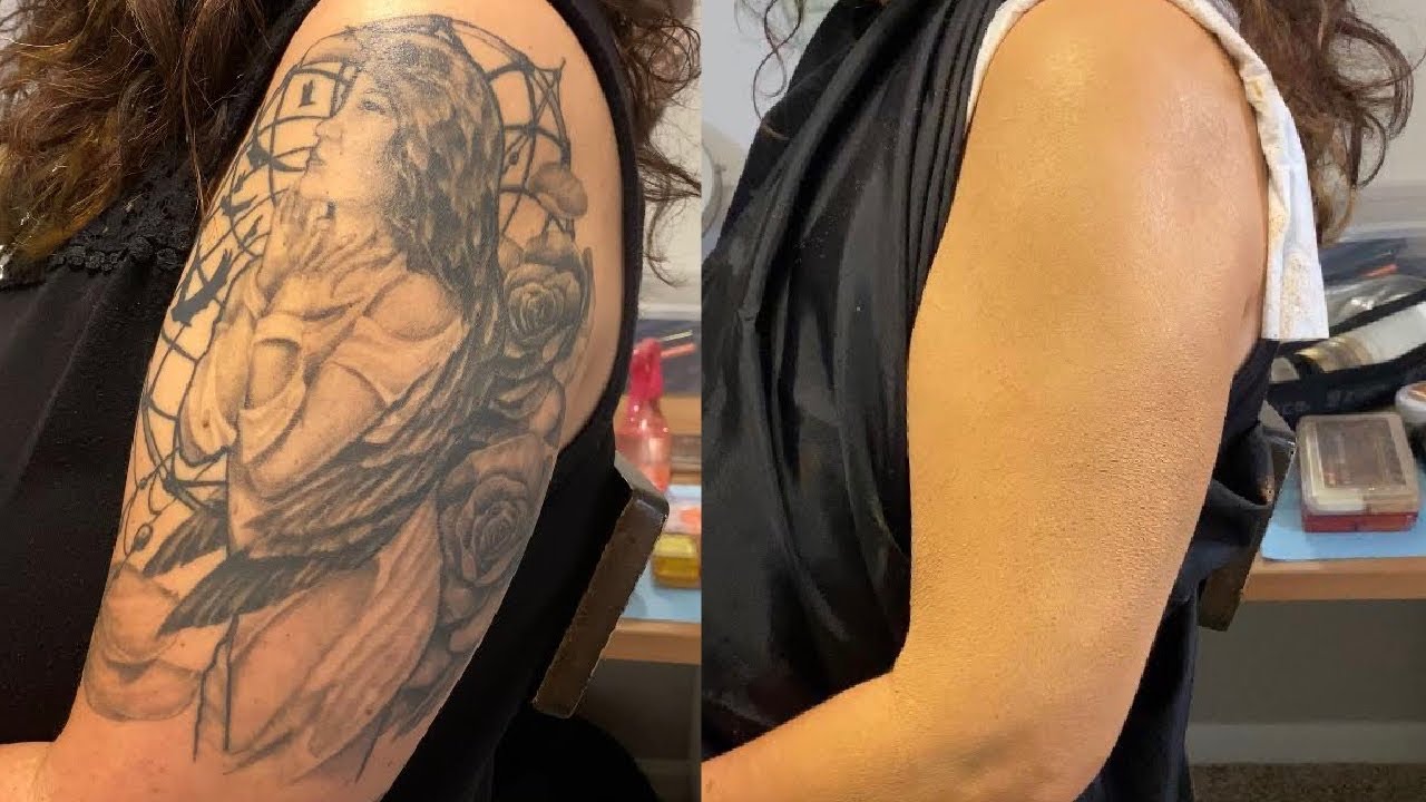 How to Choose a Cover Up Tattoo (Everything You Need to Know) | Removery