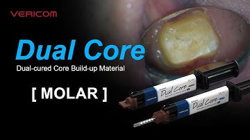 Dual Cured Core Build up Material Molar
