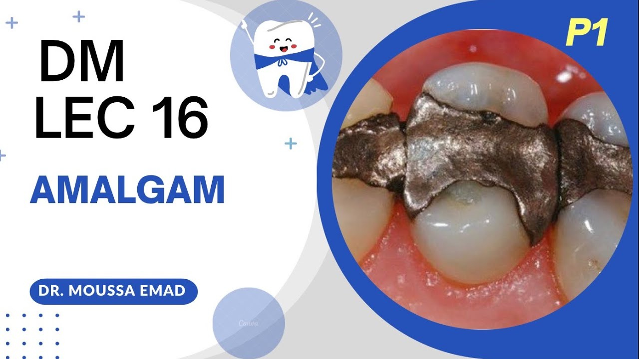 لكجر 16 - part1 دي ام | Amalgam | طب اسنان مرحلة ثانية
