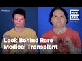 22-Year-Old Undergoes Rare Face and Hands Transplant