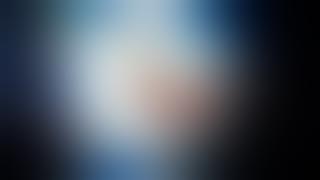 Download lagu Resorcinol and calcific metamorphosis in the radicular pulp root canal