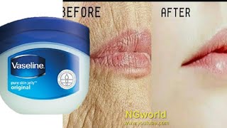 Remove WRINKLES Overnight, Magical Remedy to Remove WRINKLES, Fine Lines Permanently ll NGWorld
