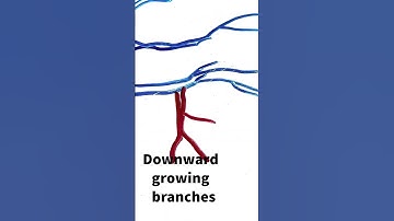 Bonsai branches to prune