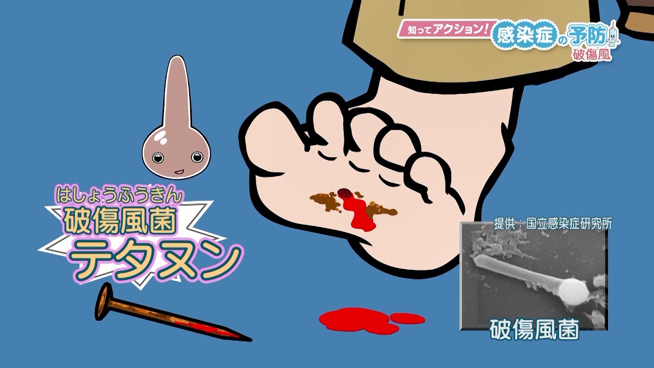 四種混合ワクチンで予防 破傷風 知ってアクション 感染症の予防 1その5 Youtube 四種混合ワクチンで予防 破傷風 知ってアクション 感染症の予防 1その5 Youtube