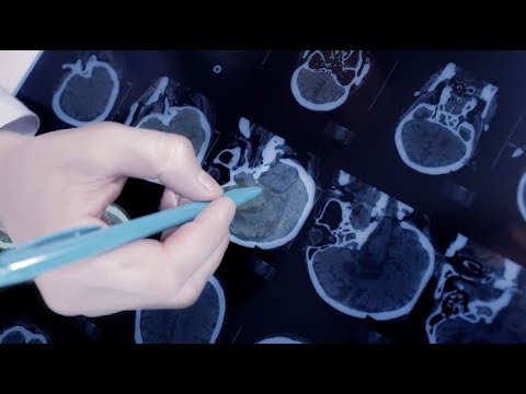 Videó: A Fájdalom észlelésének ösztrogénmodulációja új 17β-ösztradiol-előkezelési Módszerrel Petefészekben Petesejteken