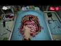 HAGO UN TRANSPLANTE DE RIÑÓN EN UNA AMBULANCIA | Surgeon Simulator #14