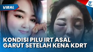 Download Lagu RAJATEGA! Wanita Asal Garut Alami KDRT, Ini Perbedaan Kondisi Wajah setelah Dianiaya oleh Suaminya MP3 Download Lagu RAJATEGA! Wanita Asal Garut Alami KDRT, Ini Perbedaan Kondisi Wajah setelah Dianiaya oleh Suaminya MP3