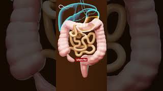 Understanding the 4 Types of Appendicitis | Symptoms & Treatment Explained Understanding the 4 Types of Appendicitis | Symptoms & Treatment Explained