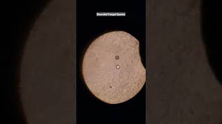 Skin Scrap For Fungus Fungal Spores Microscopic Extion Microscopy