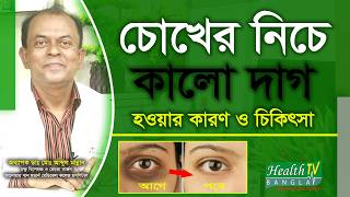 চোখের নিচে কালো দাগ হওয়ার কারণ ও চিকিৎসা || Chokher Niche Kalo Dag || Dark Circle | Health tv Bangla screenshot 4