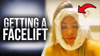 I Got A Facelift In Turkey 😲 | STORYTRENDER