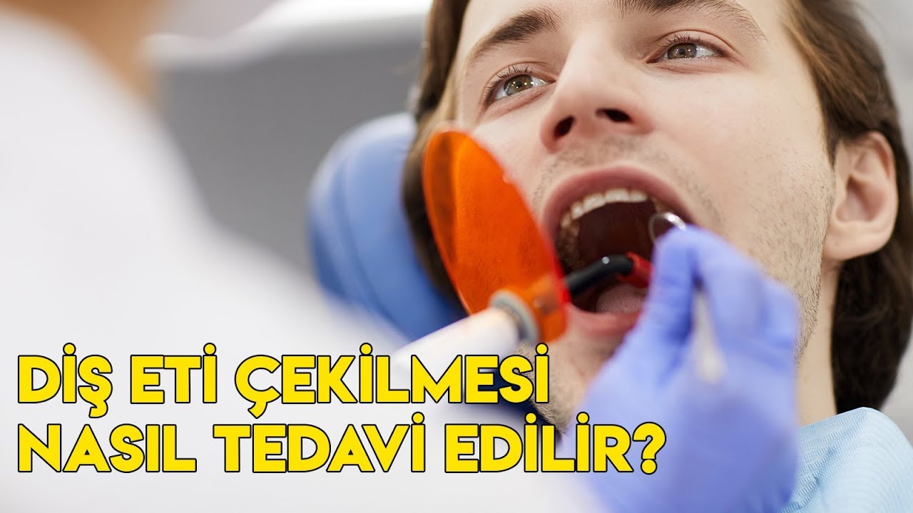 Diş Eti Çekilmesi Nasıl Tedavi Edilir? YouTube