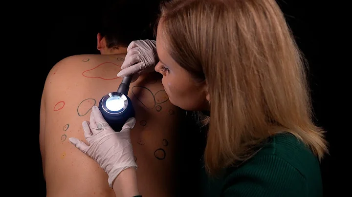 ASMR | Back inspection COMPILATION [TINGLY FRIDAY]