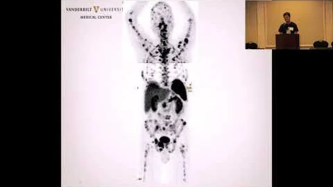 01 Liu Orlando Patient Conference 2013