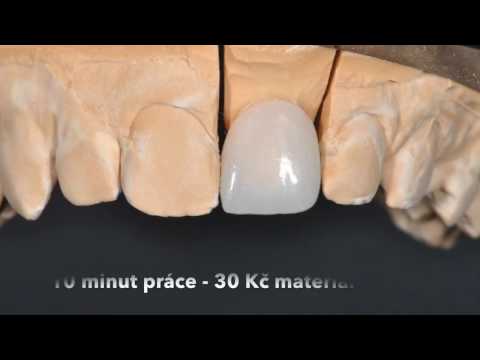Video: Jak opravit uvolněný zub: 11 kroků (s obrázky)